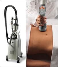 VelaShape treatments at our dermatologists office in Reno .